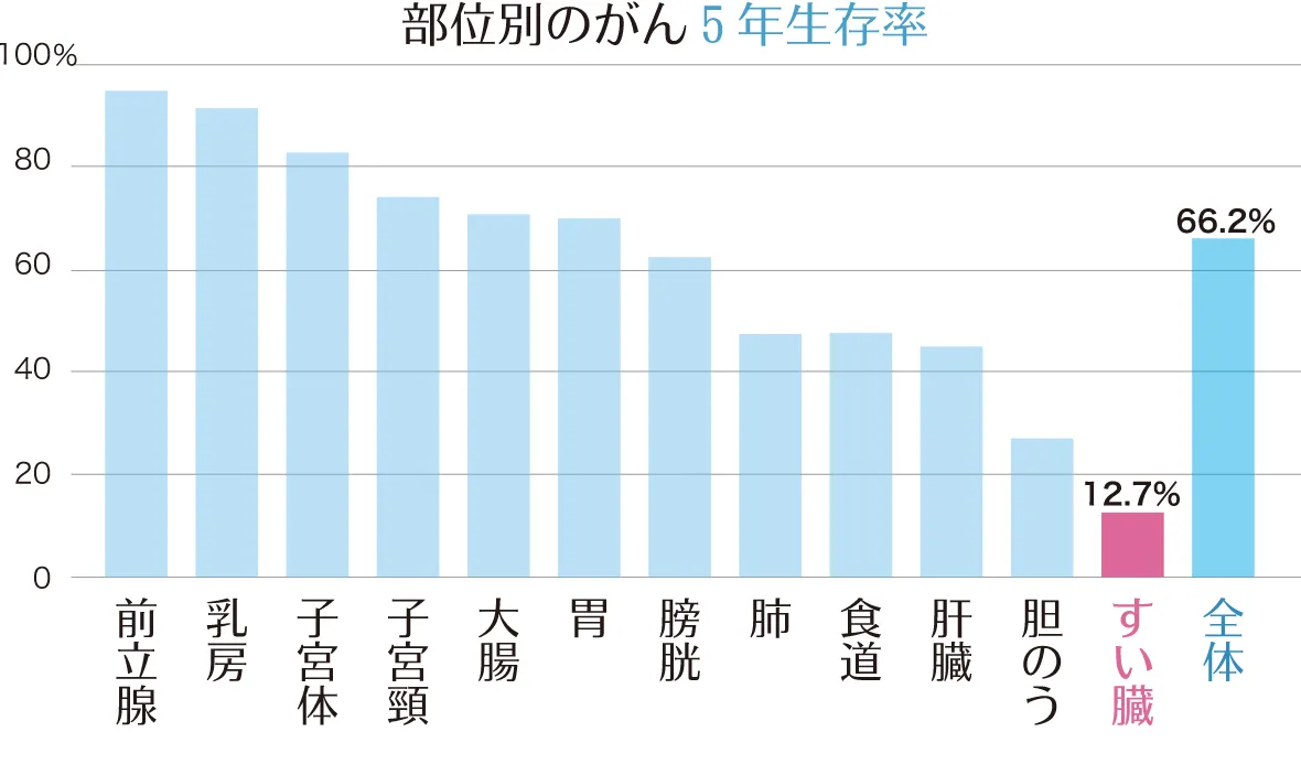 すい臓がんの撮影画像