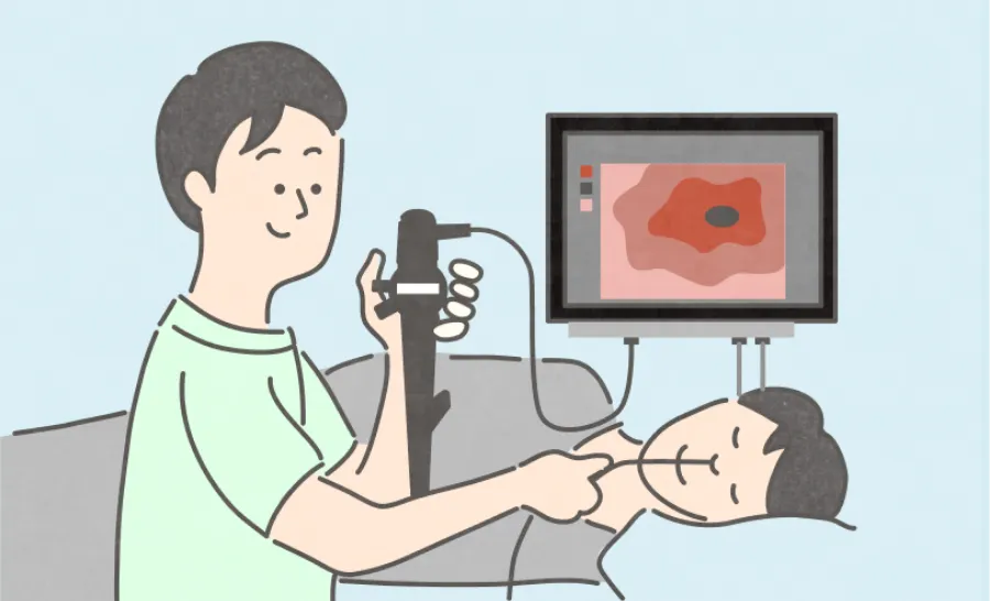 胃がんの撮影画像