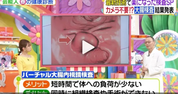 TV番組出演の案内画像