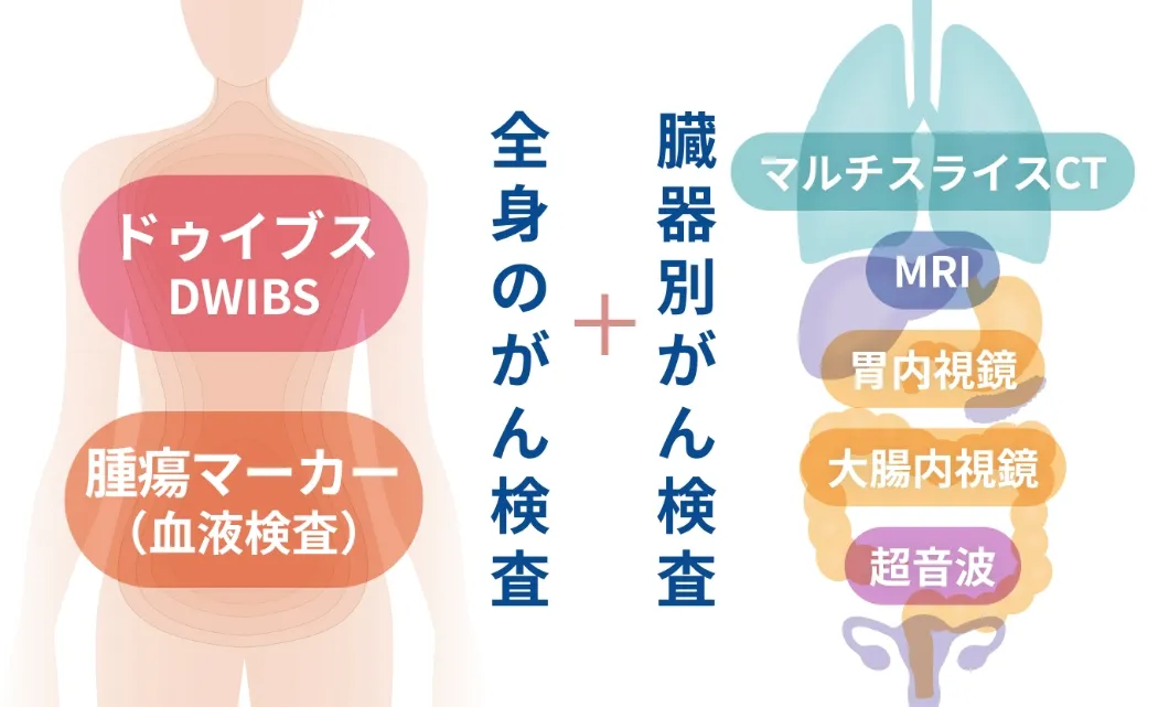 全身がん検診と臓器別がん検診のイメージ図