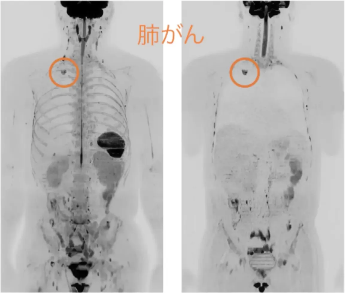 ドゥイブス検査の全身画像