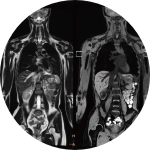 ドゥイブス検査の画像