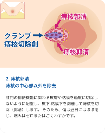 flow card
