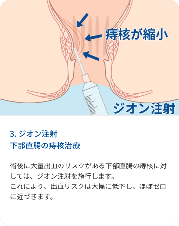flow card