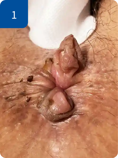 手術前