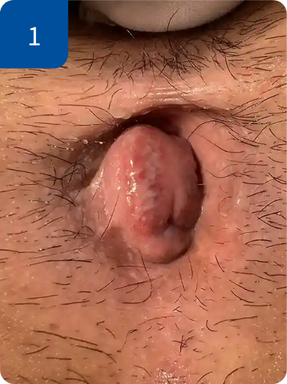 手術前