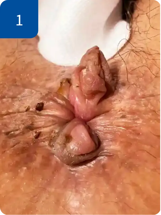 手術前