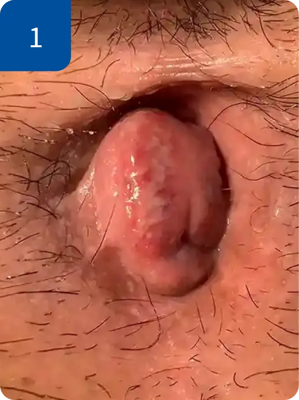 手術前