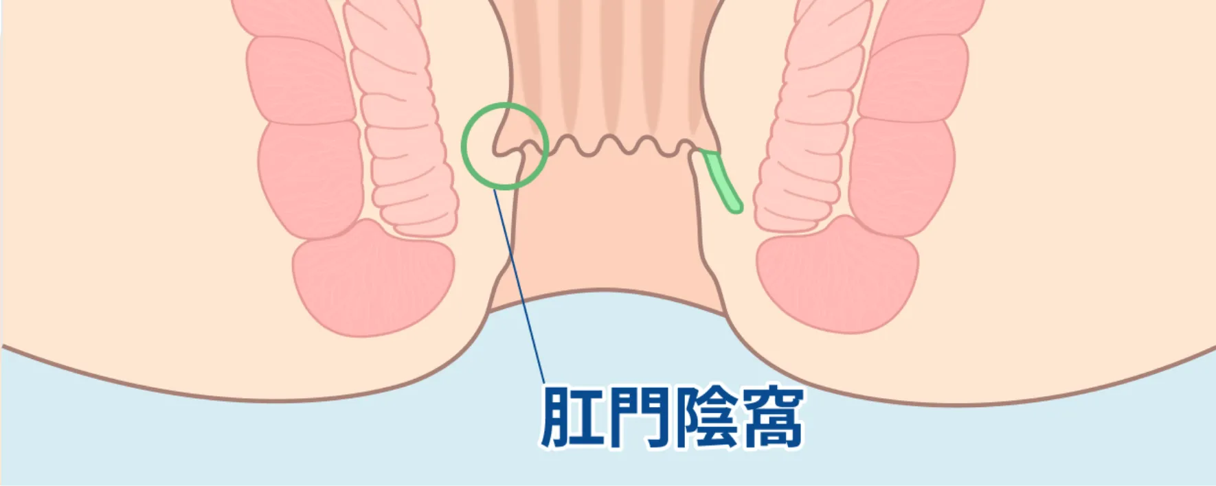 初期感染