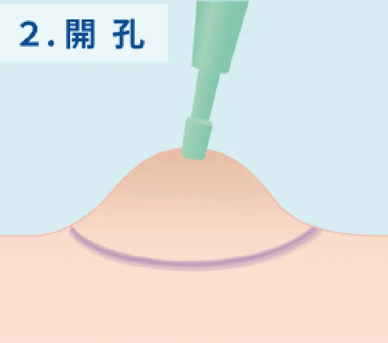 開孔